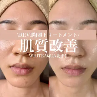 WHITE AQUA 北千住店のエステ・リラクイメージ