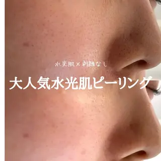 最速小顔・肌質管理 ❣️エスポワールのエステ・リラクイメージ