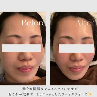 肌質改善サロン🌻 Nico laughのエステ・リラクイメージ