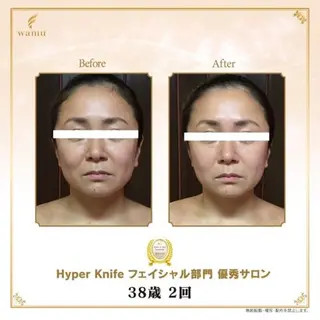 所沢痩身小顔コルギ AromaQueenのエステ・リラクイメージ