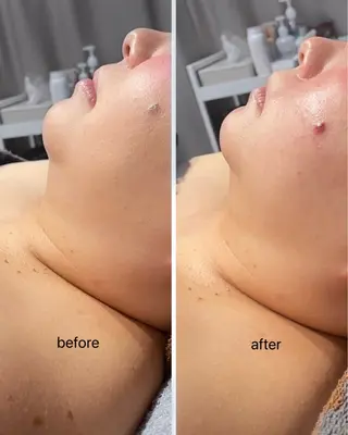 【痩身・脱毛サロン】 REBISKIN🌱のエステ・リラクイメージ