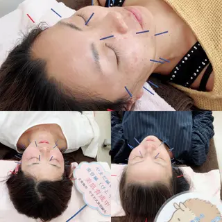 やまだ鍼灸接骨院（やまだしんきゅうせっこついん）所属・山田 晃のエステ・リラクイメージ