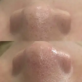 Del'm豊橋所属・豊橋De'Im 安部のエステ・リラクイメージ