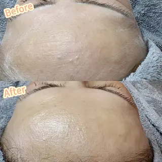 Hit. シュガーリング豊橋のエステ・リラクイメージ