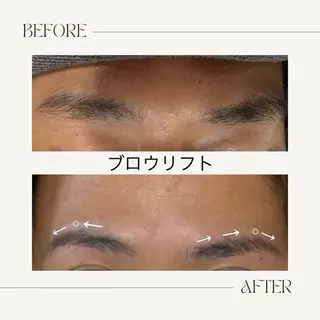 アイブロウ 脱毛・ﾌｪｲｼｬﾙ 眉毛/山崎のエステ・リラクイメージ