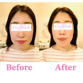 Cellfish ~セルフィッシュ~のエステ・リラクイメージ