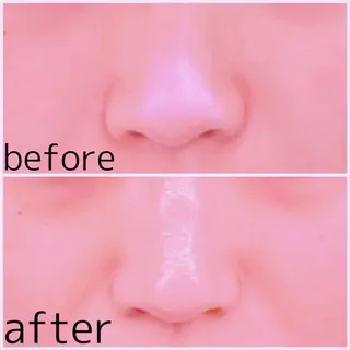 MORE BEAUTY ESTHE 本通り店所属・more 𓍯 のエステ・リラクイメージ