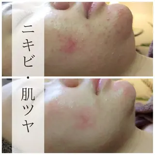 痩身・小顔salon 🌿‬北18条サロンのエステ・リラクイメージ