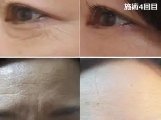 全身脱毛＆VIO脱毛 紹介率№1♪リナ♪のエステ・リラクイメージ