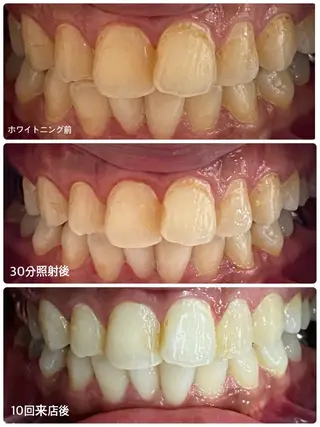 ホワイトニングサロン ラウレアのその他イメージ