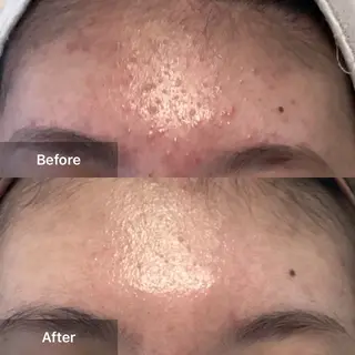 ハーブピーリング 専門店MOKA所属・ハーブピーリング専門 MOKAのエステ・リラクイメージ