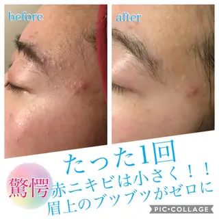 ミディアム カラー パーマ ヘアアレンジ キッズ ネイル マツエク・マツパ Ensor Clair所属・EnsorClair 代表 野口真央のエステ・リラクイメージ