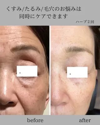 カムイ所属・カムイ 山﨑のエステ・リラクイメージ