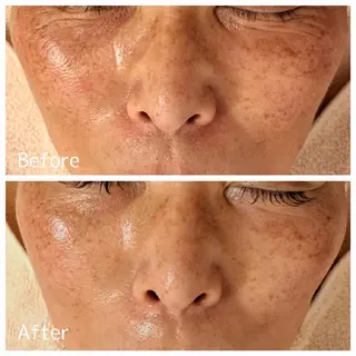 フェイシャル専門サロ ン ERINのエステ・リラクイメージ