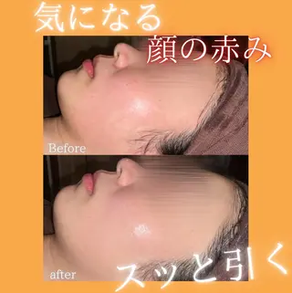 🫧ビュースタ 伊藤🫧のエステ・リラクイメージ