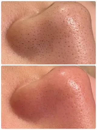 【リベルハーブピーリング認定店】敏感肌・美白脱毛専門店Dione立川店所属・Dione 立川店のエステ・リラクイメージ