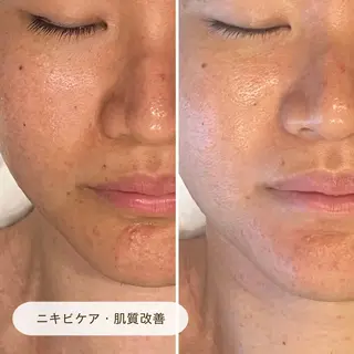 CURATED SKINのエステ・リラクイメージ