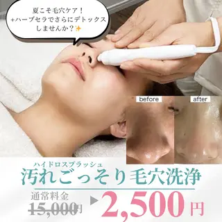 Renature リナチュールのエステ・リラクイメージ