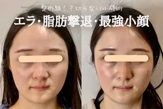 最速小顔・肌質管理 ❣️エスポワールのエステ・リラクイメージ