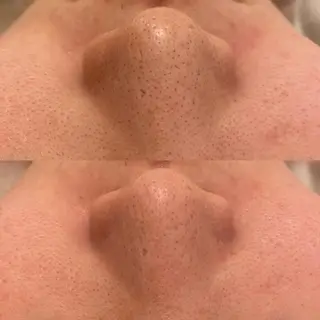 ✨美肌水光✨ アトリエリュバンのエステ・リラクイメージ