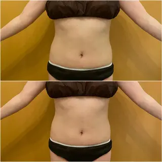 ✨美肌水光✨ アトリエリュバンのエステ・リラクイメージ