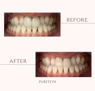 ホワイトニングサロンPURETETH所属・ホワイトニングサロン PURETETHのエステ・リラクイメージ