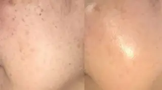 肌質改善・脱毛サロン Luangeのエステ・リラクイメージ