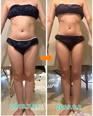 ショート カラー パーマ ヘアアレンジ メンズ キッズ ネイル マツエク・マツパ 痩身&ボディ 結果出し🌟丹野のエステ・リラクイメージ