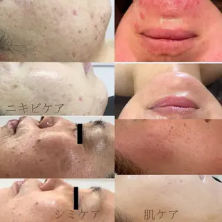 ホワイトニング・ハーブピーリング・フェイシャルサロンSUN所属・SUN MIWAのエステ・リラクイメージ