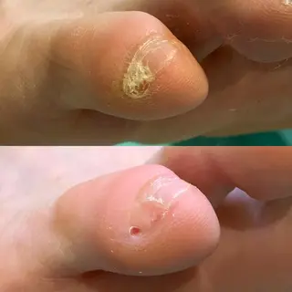 東京巻き爪アカデミー所属・東京巻き爪 アカデミーのエステ・リラクイメージ