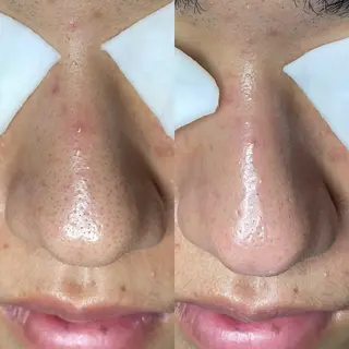 Re:Belle所属・Re:Belle 久留米 : 中島のエステ・リラクイメージ