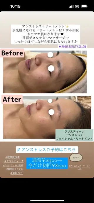 ブライダル痩身×脱毛 尼崎駅前サロンのエステ・リラクイメージ