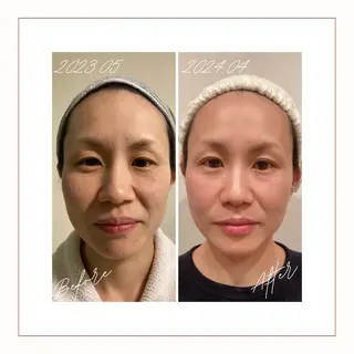 小顔×肌質改善サロン soin〔ソワン〕のエステ・リラクイメージ