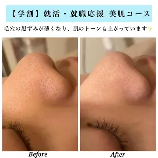 Bellesthe (ベルエステ)のエステ・リラクイメージ