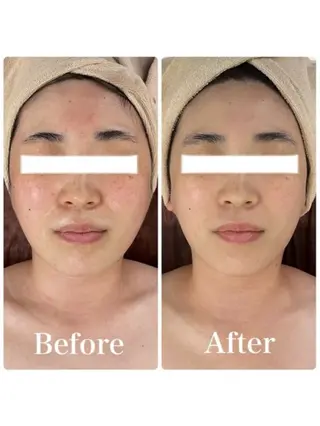 メンズ 小顔フェイシャル 専門店Soarのエステ・リラクイメージ