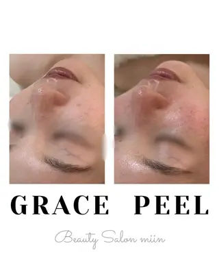 韓国肌管理 白玉肌管理®︎のエステ・リラクイメージ