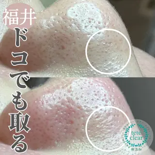 毛穴ケア専門サロン Yourmeユアミーのエステ・リラクイメージ