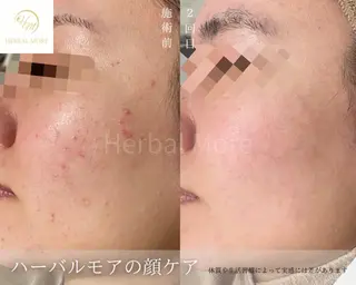 Grandir所属・ハーブピーリング専門 グランディール 武内のエステ・リラクイメージ