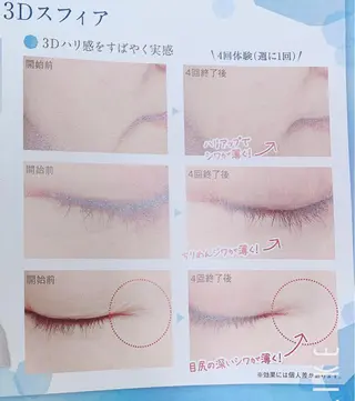 skinLabo所属・saya Mのエステ・リラクイメージ