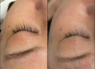 LiZA エステティックサロンのエステ・リラクイメージ