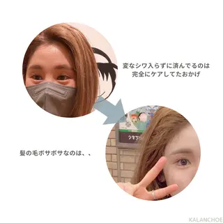 肌質改善 KALANCHOEのエステ・リラクイメージ