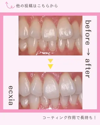 セルフホワイトニング エクシア岡崎店所属・ホワイトニング/脱毛 専門店エクシア岡崎店のその他イメージ