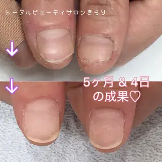 ネイル 那波 詩野のネイルデザイン