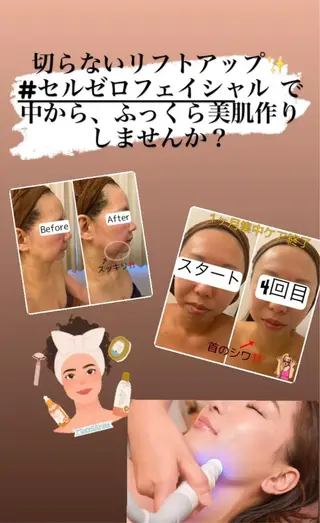 痩身リラク専門サロン 〜LUCIALL 〜のエステ・リラクイメージ