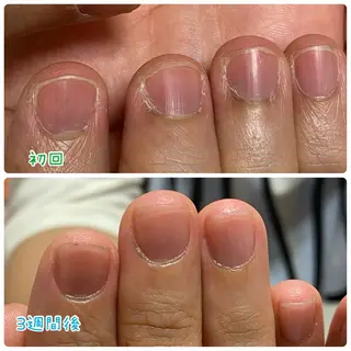 Ella nailsalon所属・Ella nail ちゆうのネイルデザイン