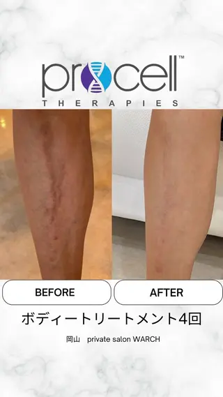 WARCH Marieのその他イメージ