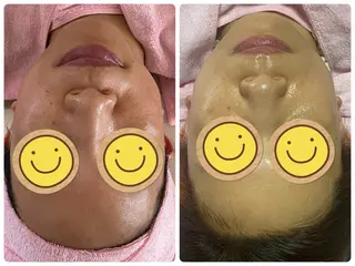 Salon Rion所属・Rion 野々村のエステ・リラクイメージ