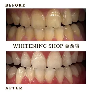 メンズ ホワイトニング ショップ葛西店のその他イメージ