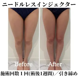 トータルビューティー サロンSalaのマツエク・マツパデザイン