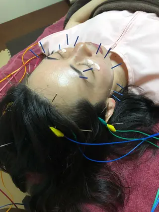 美容鍼灸女性専用 りんご鍼灸治療院のその他イメージ
